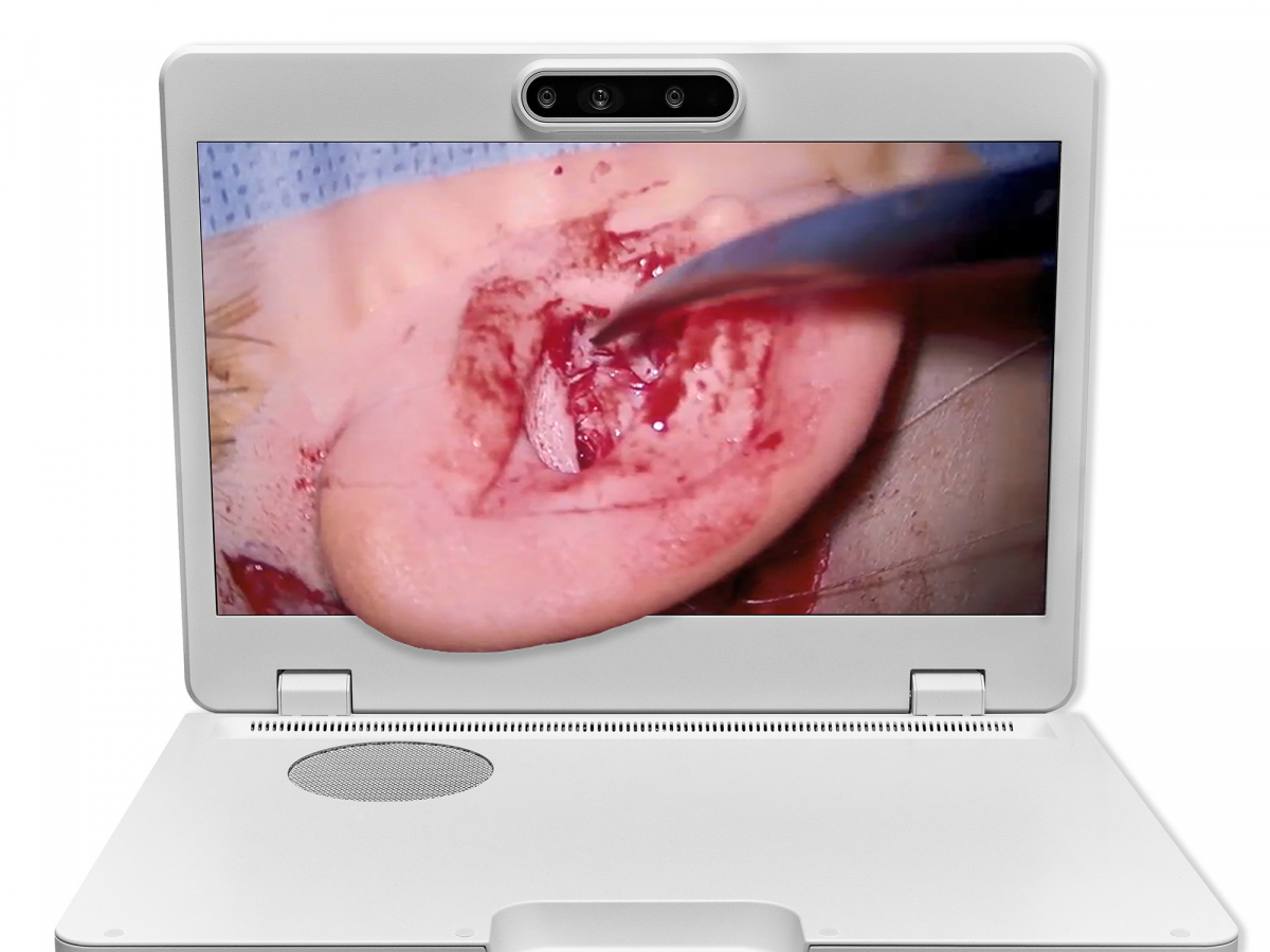 达擎之＂Heads-up 3D显微手术显示系统＂，整合4K裸眼3D显示及眼球追踪系统，具备快速追踪人眼移动位置功能，减轻医师长时间维持固定姿势的负担，让医师能有更宽广清晰的3D立体视野及更舒适的姿势来执行手术。